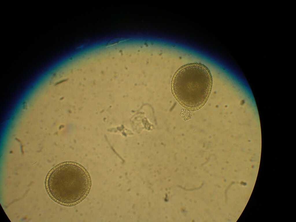 Two roundworm eggs as seen under the microscope.